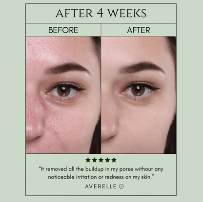 Holy Basil Bubble Mask